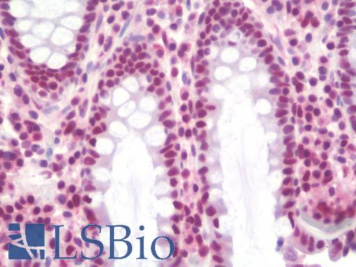 SSB / La Antibody - Anti-SSB / La antibody IHC staining of human colon. Immunohistochemistry of formalin-fixed, paraffin-embedded tissue after heat-induced antigen retrieval. Antibody concentration 10 ug/ml.