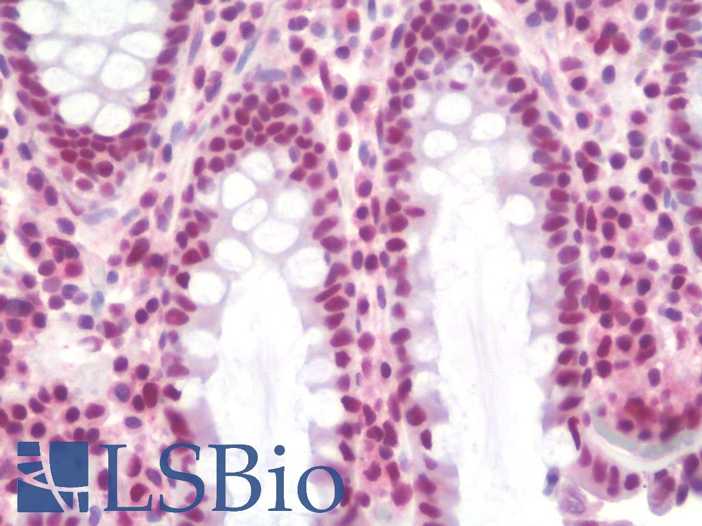 SSB / La Antibody - Anti-SSB / La antibody IHC staining of human colon. Immunohistochemistry of formalin-fixed, paraffin-embedded tissue after heat-induced antigen retrieval. Antibody concentration 10 ug/ml.