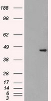 SSB / La Antibody - HEK293T cells were transfected with the pCMV6-ENTRY control (Left lane) or pCMV6-ENTRY SSB (Right lane) cDNA for 48 hrs and lysed. Equivalent amounts of cell lysates (5 ug per lane) were separated by SDS-PAGE and immunoblotted with anti-SSB.
