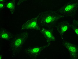 SSB / La Antibody - Immunofluorescent staining of A549 cells using anti-SSB mouse monoclonal antibody.