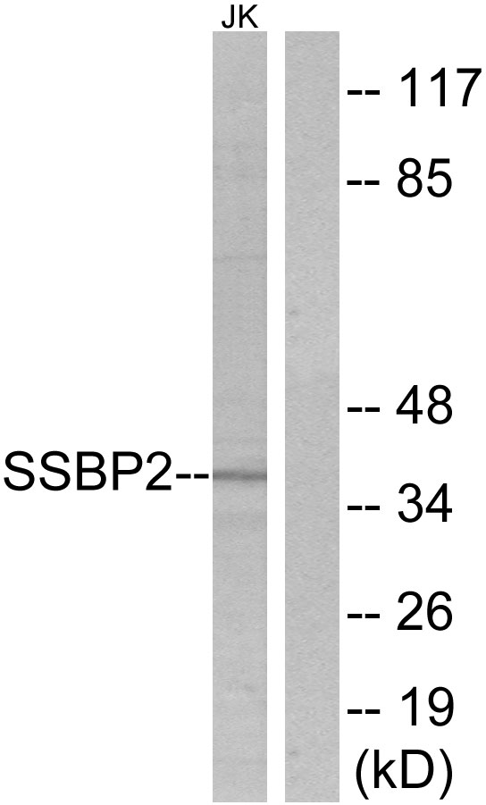 SSBP2 Antibody - Western blot analysis of lysates from Jurkat cells, using SSBP2 Antibody. The lane on the right is blocked with the synthesized peptide.