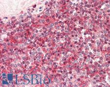 SSH3 Antibody - Human Spleen: Formalin-Fixed, Paraffin-Embedded (FFPE)
