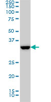 SSR1 Antibody - Western blot of SSR1 expression in HL-60.