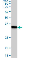 SSR1 Antibody - Western blot of SSR1 expression in A-431.