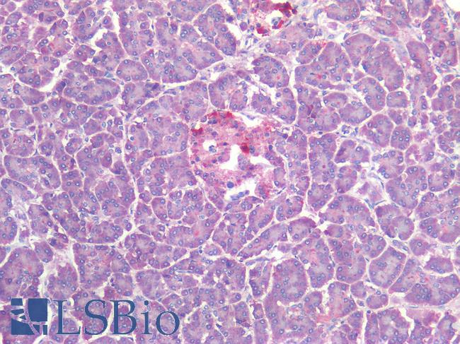 SST / Somatostatin Antibody - Human Pancreas: Formalin-Fixed, Paraffin-Embedded (FFPE)