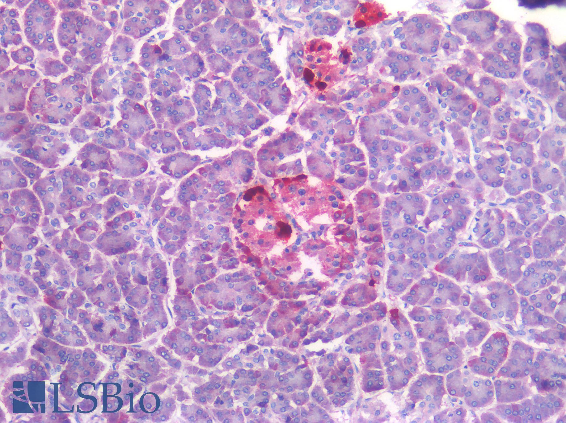 SST / Somatostatin Antibody - Human Pancreas: Formalin-Fixed, Paraffin-Embedded (FFPE)