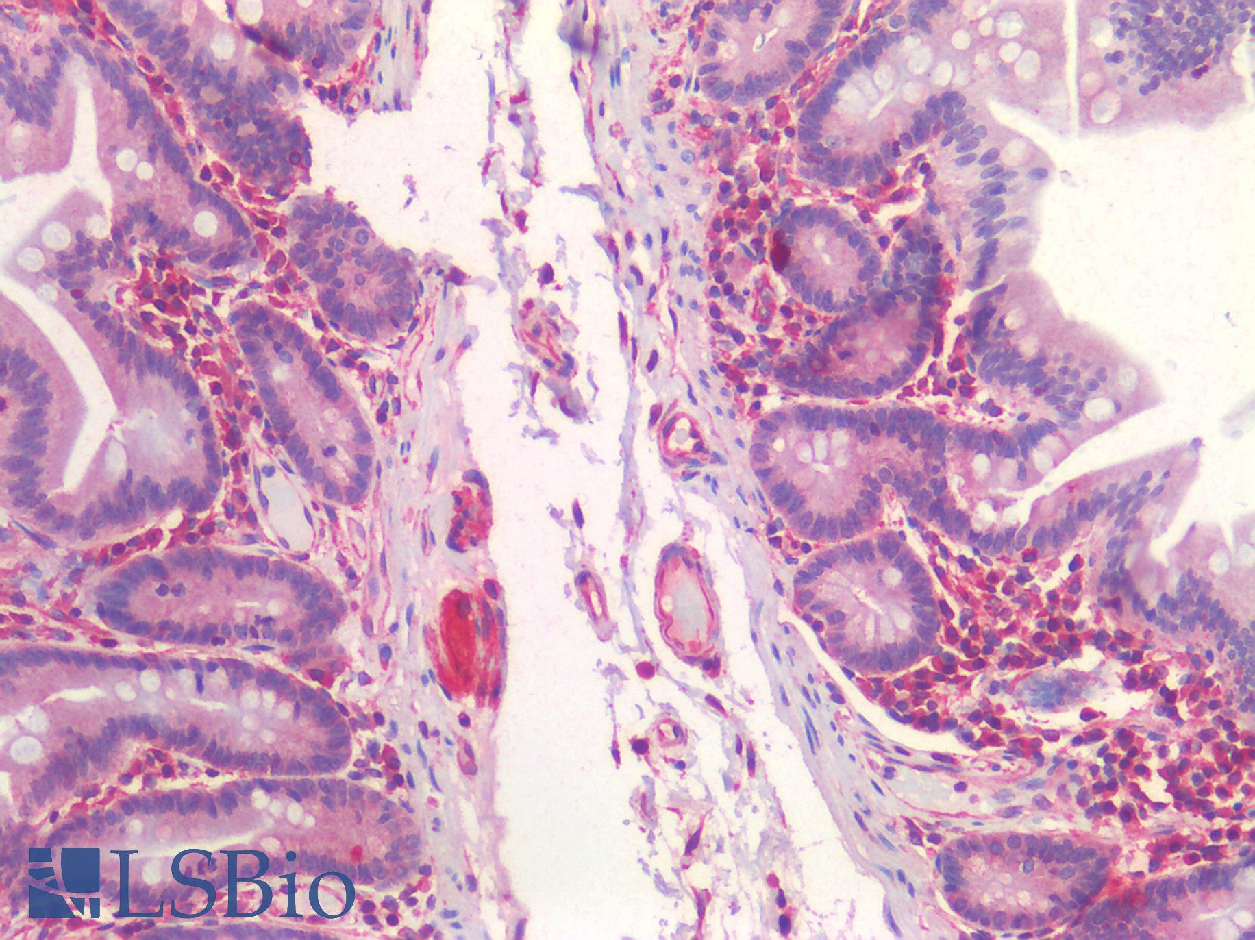SST / Somatostatin Antibody - Human Small Intestine: Formalin-Fixed, Paraffin-Embedded (FFPE)