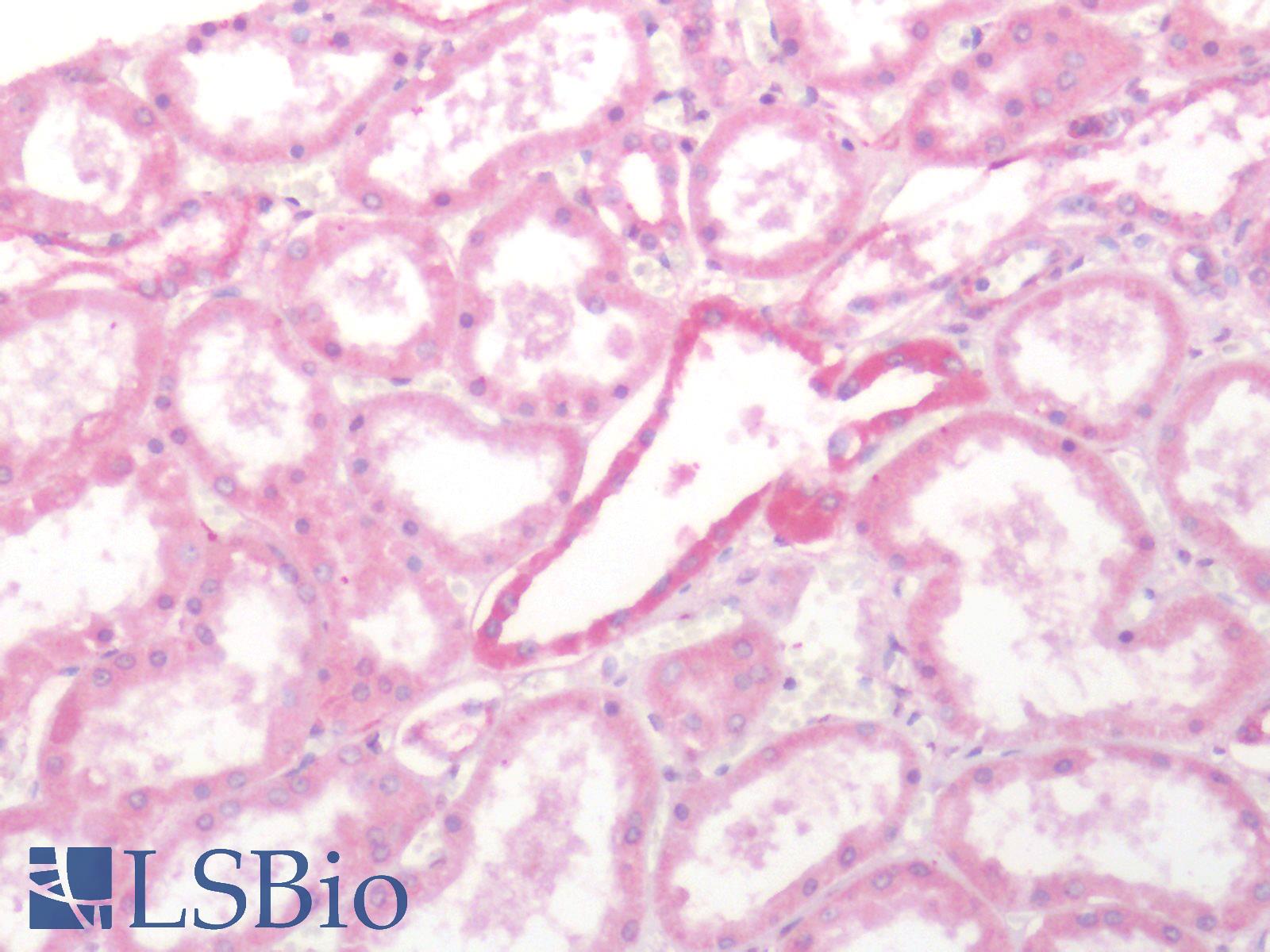 SSTR2 Antibody - Human Kidney: Formalin-Fixed, Paraffin-Embedded (FFPE)