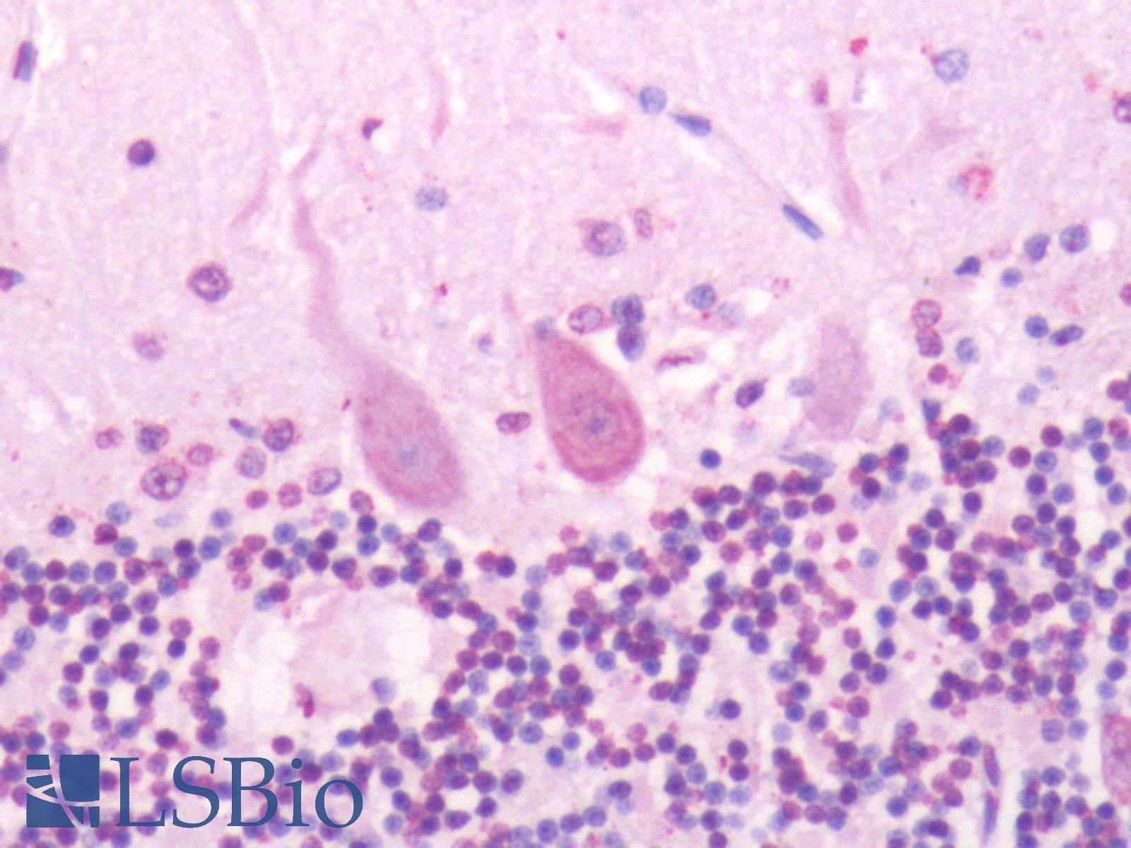 SSTR2 Antibody - Human Brain, Cerebellum: Formalin-Fixed, Paraffin-Embedded (FFPE)