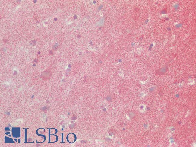 SSTR2 Antibody - Human Brain, Cortex: Formalin-Fixed, Paraffin-Embedded (FFPE)