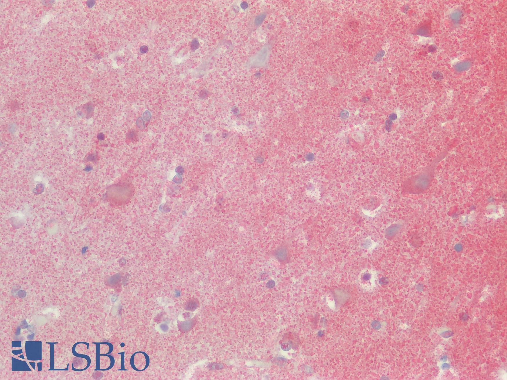 SSTR2 Antibody - Human Brain, Cortex: Formalin-Fixed, Paraffin-Embedded (FFPE)