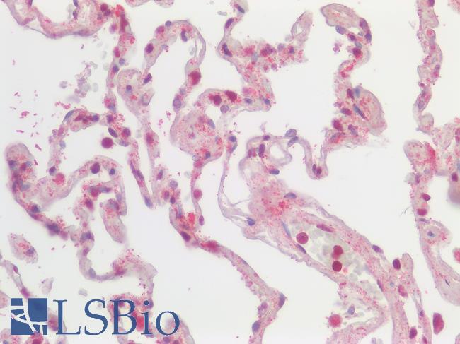 SSTR2 Antibody - Human Lung: Formalin-Fixed, Paraffin-Embedded (FFPE)