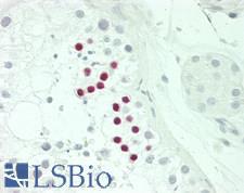 SSX2 Antibody - Human Testis: Formalin-Fixed, Paraffin-Embedded (FFPE)