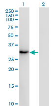 SSX2 Antibody - Western blot of SSX2 expression in transfected 293T cell line by SSX2 monoclonal antibody (M01), clone 1A4.