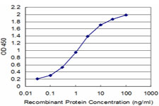 SSX2 Antibody - Detection limit for recombinant GST tagged SSX2 is approximately 0.03 ng/ml as a capture antibody.