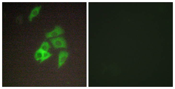 ST14 / Matriptase Antibody - Immunofluorescence analysis of A549 cells, using ST14 Antibody. The picture on the right is blocked with the synthesized peptide.