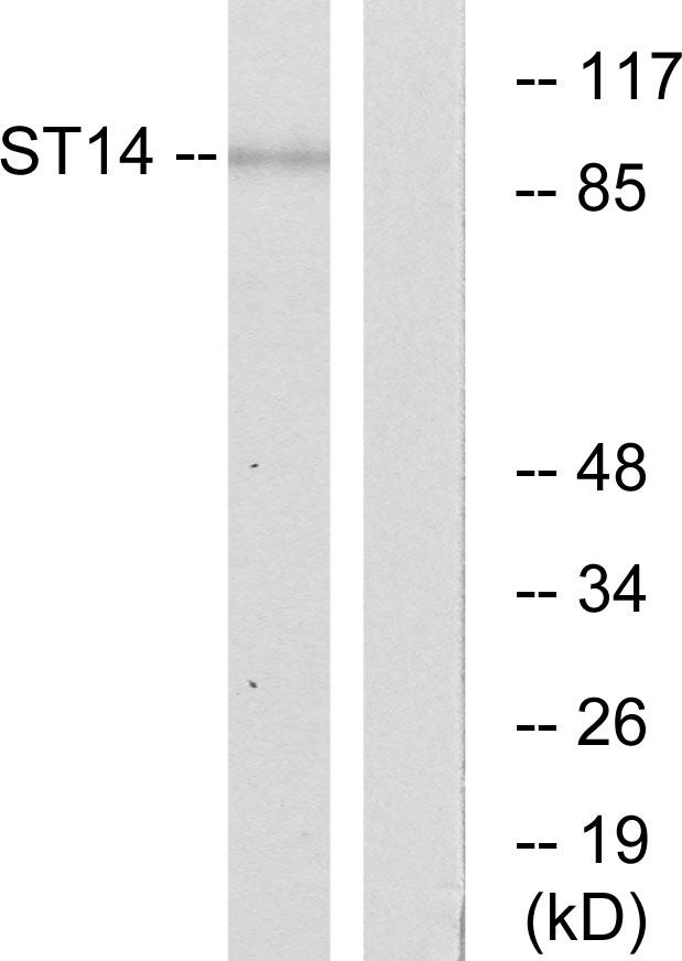 ST14 / Matriptase Antibody - Western blot analysis of lysates from A549 cells, using ST14 Antibody. The lane on the right is blocked with the synthesized peptide.