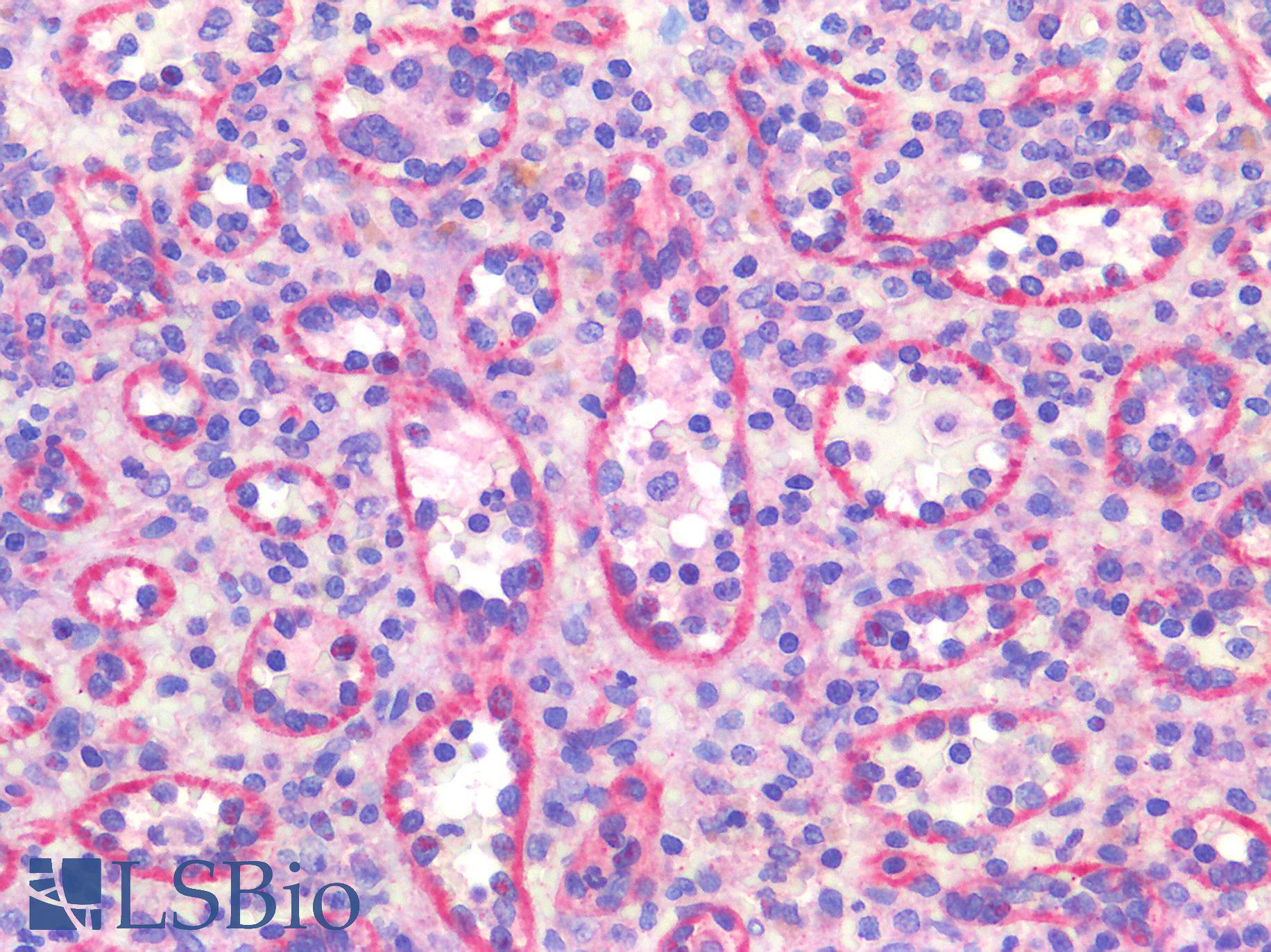 ST14 / Matriptase Antibody - Human Spleen, Membranous Staining: Formalin-Fixed, Paraffin-Embedded (FFPE)