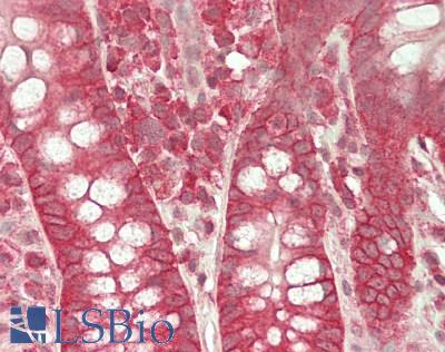 ST14 / Matriptase Antibody - Human Small Intestine: Formalin-Fixed, Paraffin-Embedded (FFPE)