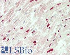 ST18 Antibody - Human Heart: Formalin-Fixed, Paraffin-Embedded (FFPE)