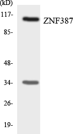 ST18 Antibody - Western blot analysis of the lysates from COLO205 cells using ZNF387 antibody.