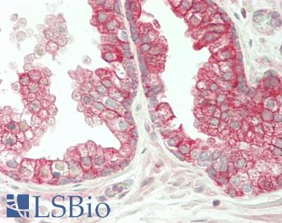 ST8SIA2 / STX Antibody - Human Prostate: Formalin-Fixed, Paraffin-Embedded (FFPE)