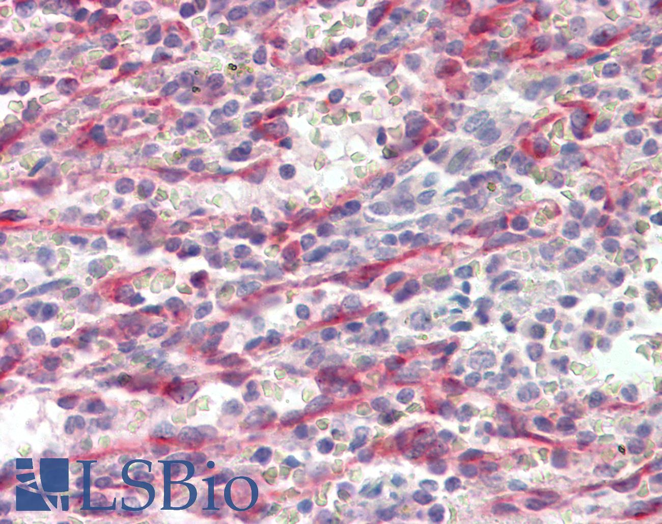 STAB1 Antibody - Anti-STAB1 antibody IHC staining of human spleen. Immunohistochemistry of formalin-fixed, paraffin-embedded tissue after heat-induced antigen retrieval.