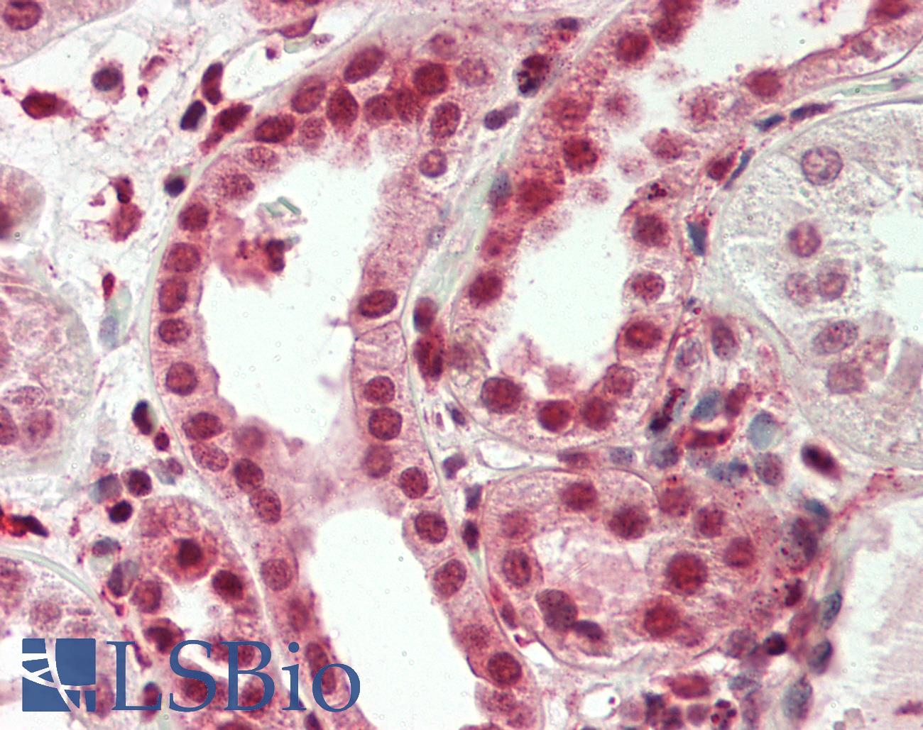 STAG1 / SA1 Antibody - Human Kidney: Formalin-Fixed, Paraffin-Embedded (FFPE)