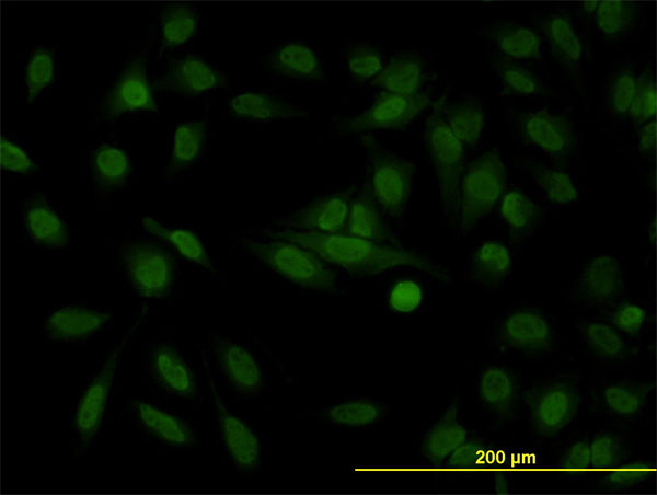 STAG1 / SA1 Antibody - Immunofluorescence of monoclonal antibody to STAG1 on HeLa cell. [antibody concentration 10 ug/ml]