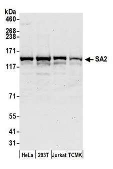 STAG2 Antibody - Detection of human and mouse SA2 by western blot. Samples: Whole cell lysate (50 µg) from HeLa, HEK293T, Jurkat, and mouse TCMK-1 cells prepared using NETN lysis buffer. Antibody: Affinity purified rabbit anti-SA2 antibody used for WB at 0.1 µg/ml. Detection: Chemiluminescence with an exposure time of 30 seconds.