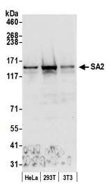 STAG2 Antibody - Detection of human and mouse SA2 by western blot. Samples: Whole cell lysate (50 µg) from HeLa, HEK293T, and mouse NIH 3T3 cells prepared using NETN lysis buffer. Antibody: Affinity purified rabbit anti-SA2 antibody used for WB at 0.1 µg/ml. Detection: Chemiluminescence with an exposure time of 10 seconds.