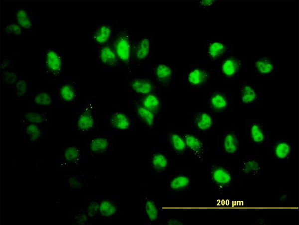 STAG2 Antibody - Immunofluorescence of monoclonal antibody to STAG2 on HeLa cell. [antibody concentration 10 ug/ml]