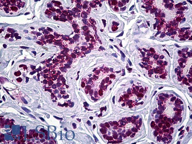 STAG2 Antibody - Anti-STAG2 antibody IHC of human breast. Immunohistochemistry of formalin-fixed, paraffin-embedded tissue after heat-induced antigen retrieval. Antibody concentration 5 ug/ml.