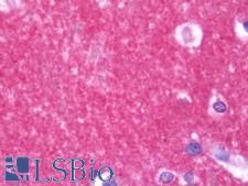 STAM1 / STAM Antibody - Anti-STAM1 / STAM antibody IHC staining of human brain, cortex. Immunohistochemistry of formalin-fixed, paraffin-embedded tissue after heat-induced antigen retrieval. Antibody concentration 7.5 ug/ml.