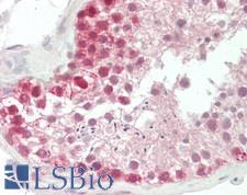 STAMBP / AMSH Antibody - Human Testis: Formalin-Fixed, Paraffin-Embedded (FFPE)