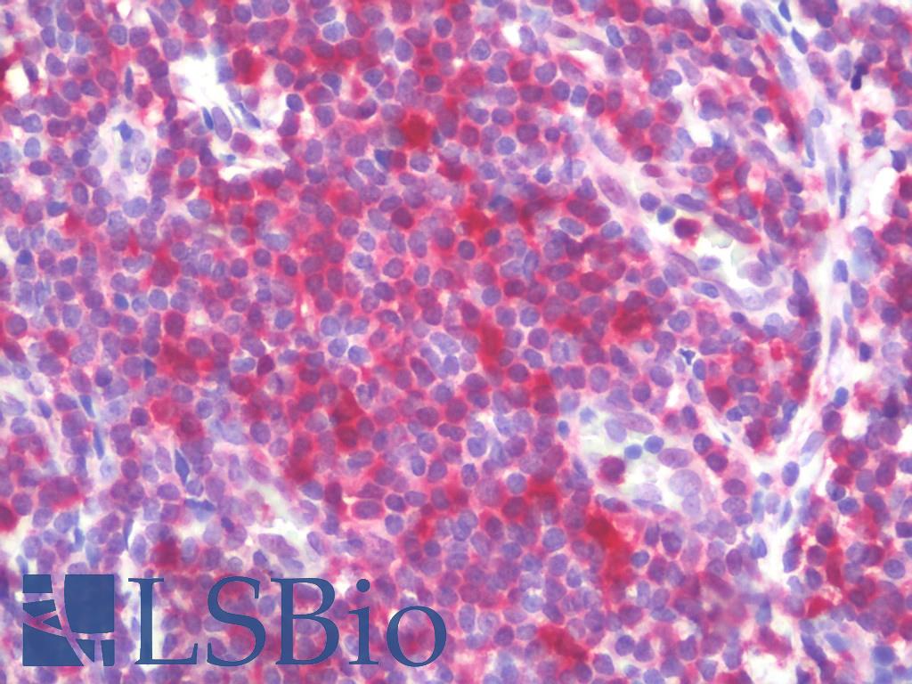 STAT1 Antibody - Anti-STAT1 antibody IHC staining of human tonsil. Immunohistochemistry of formalin-fixed, paraffin-embedded tissue after heat-induced antigen retrieval. Antibody concentration 10 ug/ml.