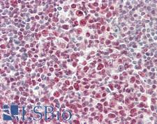 STAT1 Antibody - Human Tonsil: Formalin-Fixed, Paraffin-Embedded (FFPE)