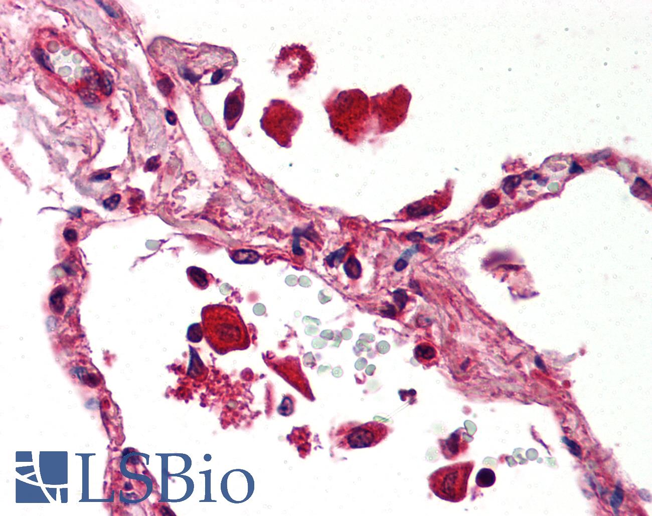 STAT1 Antibody - Anti-STAT1 antibody IHC of human lung. Immunohistochemistry of formalin-fixed, paraffin-embedded tissue after heat-induced antigen retrieval. Antibody concentration 5 ug/ml.