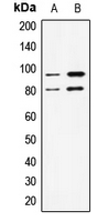 STAT1 Antibody - Western blot analysis of STAT1 expression in Jurkat (A); A431 (B) whole cell lysates.
