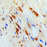 STAT1 Antibody - Immunohistochemical analysis of STAT1 staining in human brain formalin fixed paraffin embedded tissue section. The section was pre-treated using heat mediated antigen retrieval with sodium citrate buffer (pH 6.0). The section was then incubated with the antibody at room temperature and detected using an HRP conjugated compact polymer system. DAB was used as the chromogen. The section was then counterstained with hematoxylin and mounted with DPX.