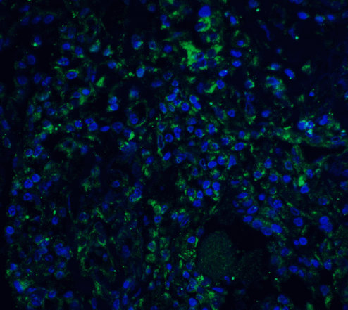 STAT1 Antibody - Immunofluorescence of STAT1 alpha in human colon tissue with STAT1 alpha antibody at 20 ug/mL.  Green: STAT1 alpha Antibody  Blue: DAPI staining
