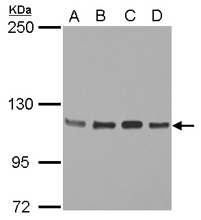 STAT2 Antibody - Sample (30 ug of whole cell lysate) A: Jurkat B: Raji C: K562 D: THP-1 5% SDS PAGE STAT2 antibody diluted at 1:2000