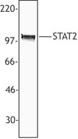 STAT2 Antibody - Hela cell extract was resolved by electrophoresis, transferred to nitrocellulose, and probed with rabbit anti-STAT2 polyclonal antibody. Proteins were visualized using a donkey anti-rabbit secondary antibody conjugated to HRP and a chemiluminescence system.