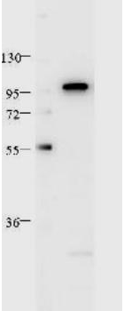 STAT2 Antibody - Anti-Stat2 Monoclonal Antibody - Western Blot. HeLa whole cell lysate was loaded at 1 ug. The blot was blocked with 1% BSA in TBST for 30 min at RT, then washed and incubated with anti-Stat2 antibody in 3% BSA/TBST at 1:1000 overnight at 4C. After washing, blot was incubated with HRP Rb a-Ms IgG (LS-C60772) antibody in blocking buffer for 30 minutes at RT. Data was collected using Bio-Rad VersaDoc 4000 MP.