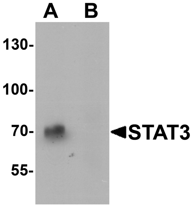 STAT3 Antibody - Western blot analysis of STAT3 in human small intestine tissue lysate with STAT3 antibody at 1 ug/ml in (A) the absence and (B) the presence of blocking peptide.
