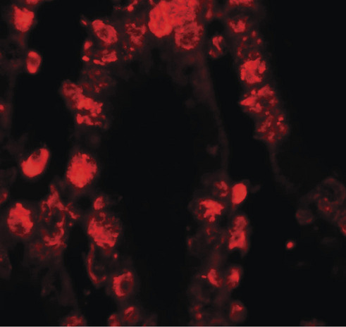 STAT3 Antibody - Immunofluorescence of STAT3 in human small intestine tissue with STAT3 antibody at 20 ug/ml.