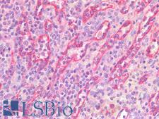 STAT5A Antibody - Human Spleen: Formalin-Fixed, Paraffin-Embedded (FFPE)