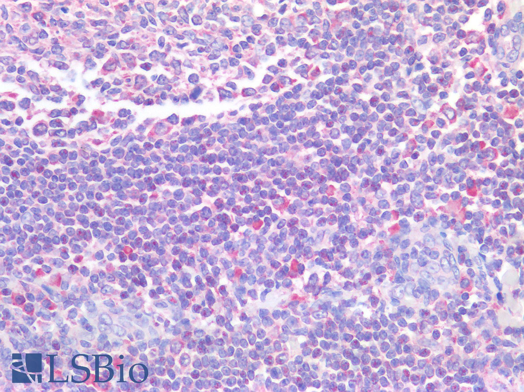 STAT5A Antibody - Human Tonsil: Formalin-Fixed, Paraffin-Embedded (FFPE)