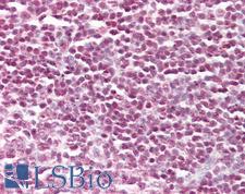 STAT5A Antibody - Anti-STAT5A antibody IHC of human tonsil. Immunohistochemistry of formalin-fixed, paraffin-embedded tissue after heat-induced antigen retrieval. Antibody dilution 1:100.