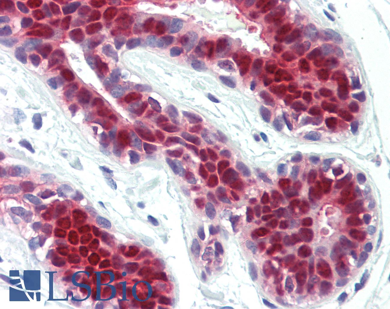 STAT5A Antibody - Anti-STAT5A antibody IHC staining of human breast. Immunohistochemistry of formalin-fixed, paraffin-embedded tissue after heat-induced antigen retrieval.
